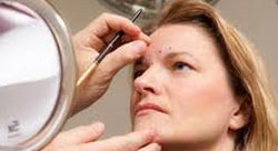 Crutchfield Dermatology Mole Removal Crutchfield Dermatology Mole Removal